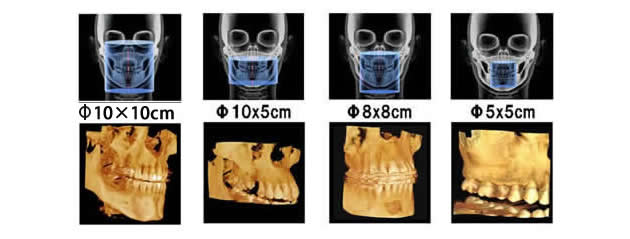 歯科用CT