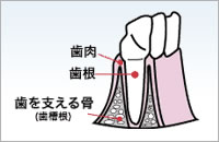 歯周病治療